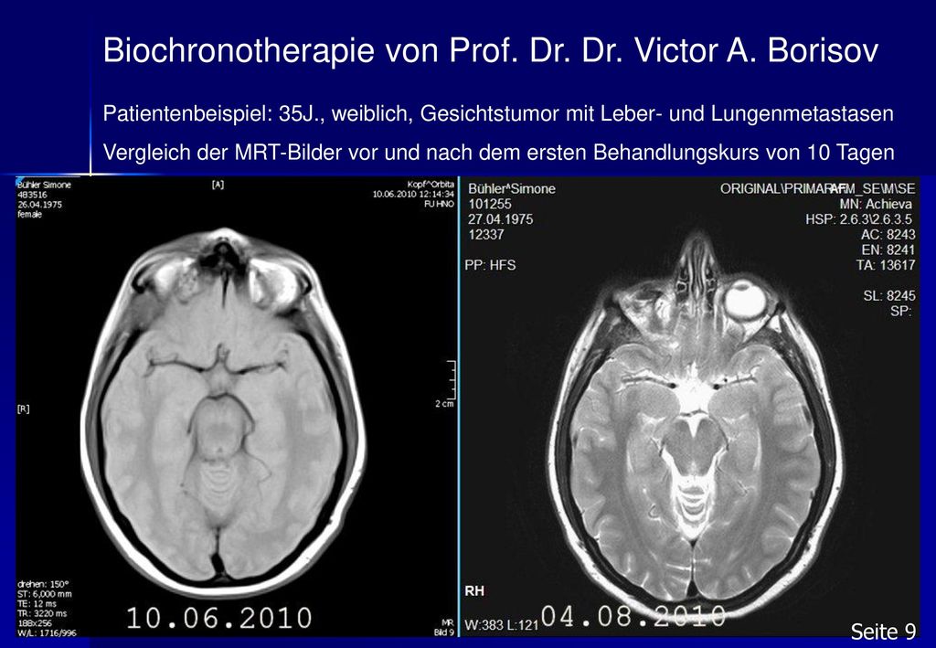 Biochronotherapie von Prof. Dr. Dr. Victor A. Borisov