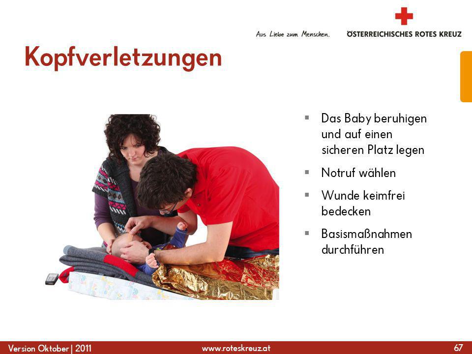 Kopfverletzungen Das Baby beruhigen und auf einen sicheren Platz legen