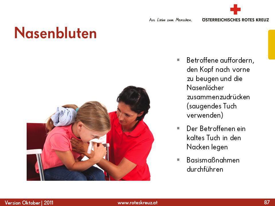 Nasenbluten Betroffene auffordern, den Kopf nach vorne zu beugen und die Nasenlöcher zusammenzudrücken (saugendes Tuch verwenden)