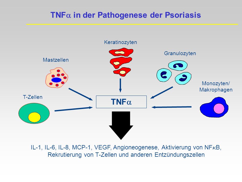 TNFa in der Pathogenese der Psoriasis