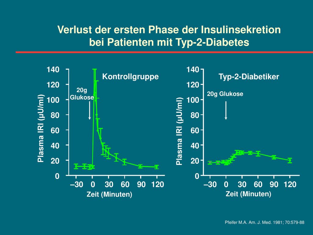 Verlust der ersten Phase der Insulinsekretion bei Patienten mit Typ-2-Diabetes