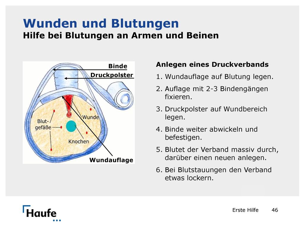 Wunden und Blutungen Hilfe bei Blutungen an Armen und Beinen