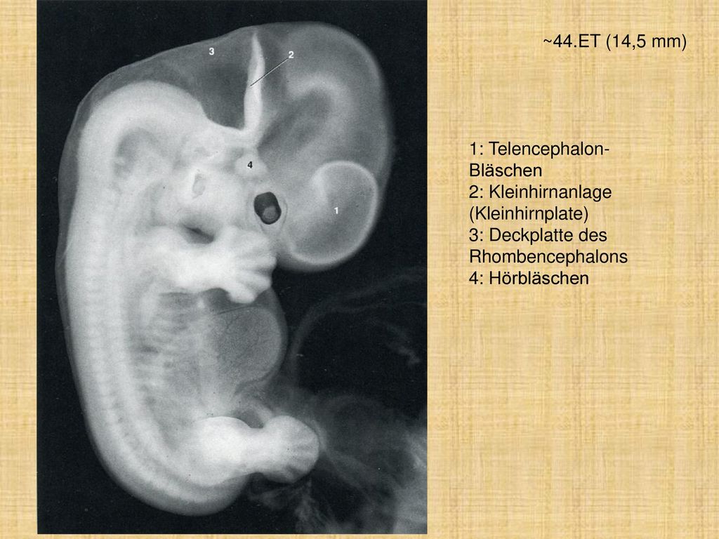 ~44.ET (14,5 mm) 1: Telencephalon-Bläschen. 2: Kleinhirnanlage (Kleinhirnplate) 3: Deckplatte des Rhombencephalons.