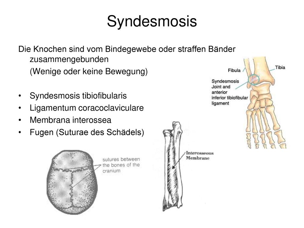 Syndesmosis Die Knochen sind vom Bindegewebe oder straffen Bänder zusammengebunden. (Wenige oder keine Bewegung)