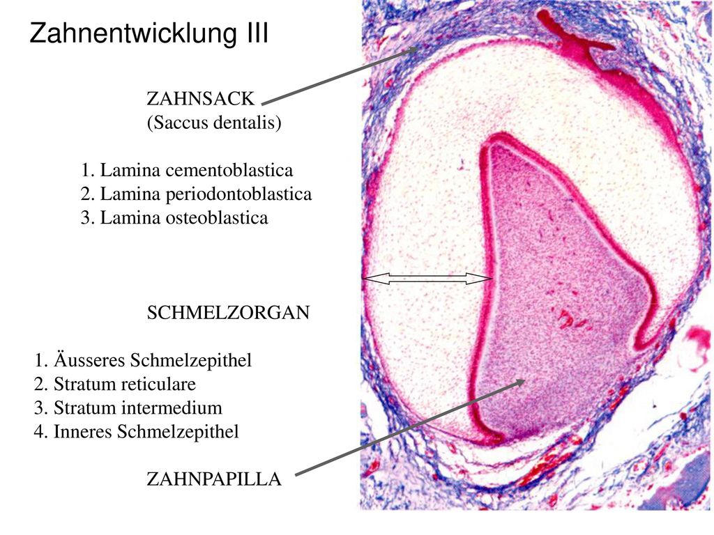 Zahnentwicklung III ZAHNSACK (Saccus dentalis)