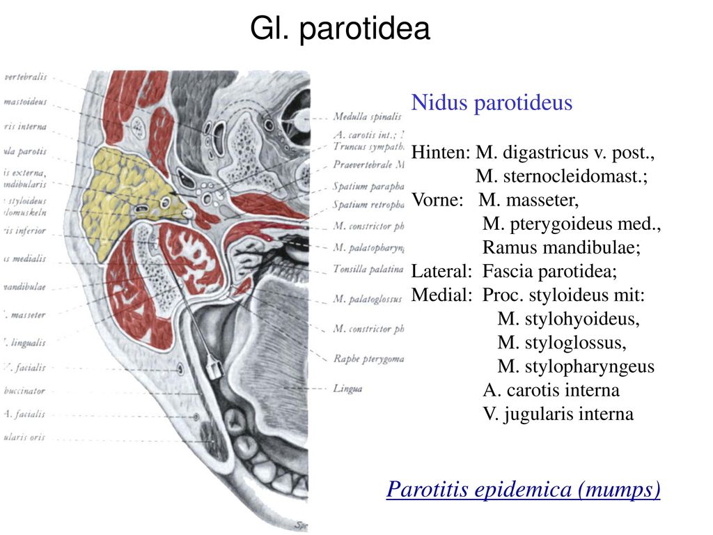Gl. parotidea Nidus parotideus Parotitis epidemica (mumps)
