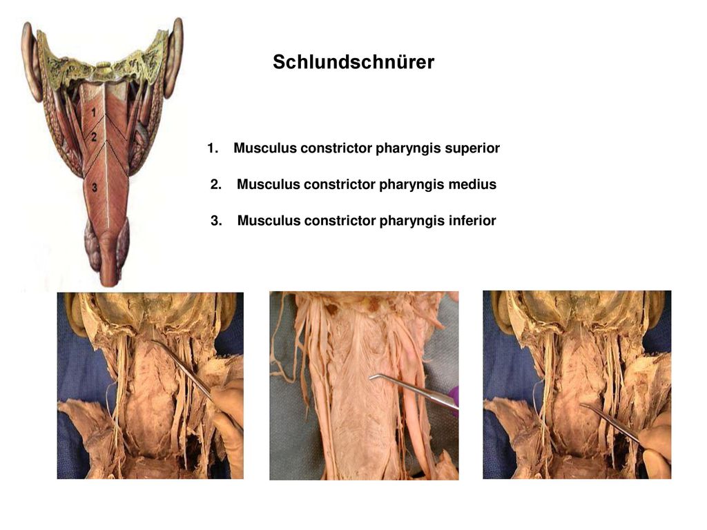 Schlundschnürer Musculus constrictor pharyngis superior