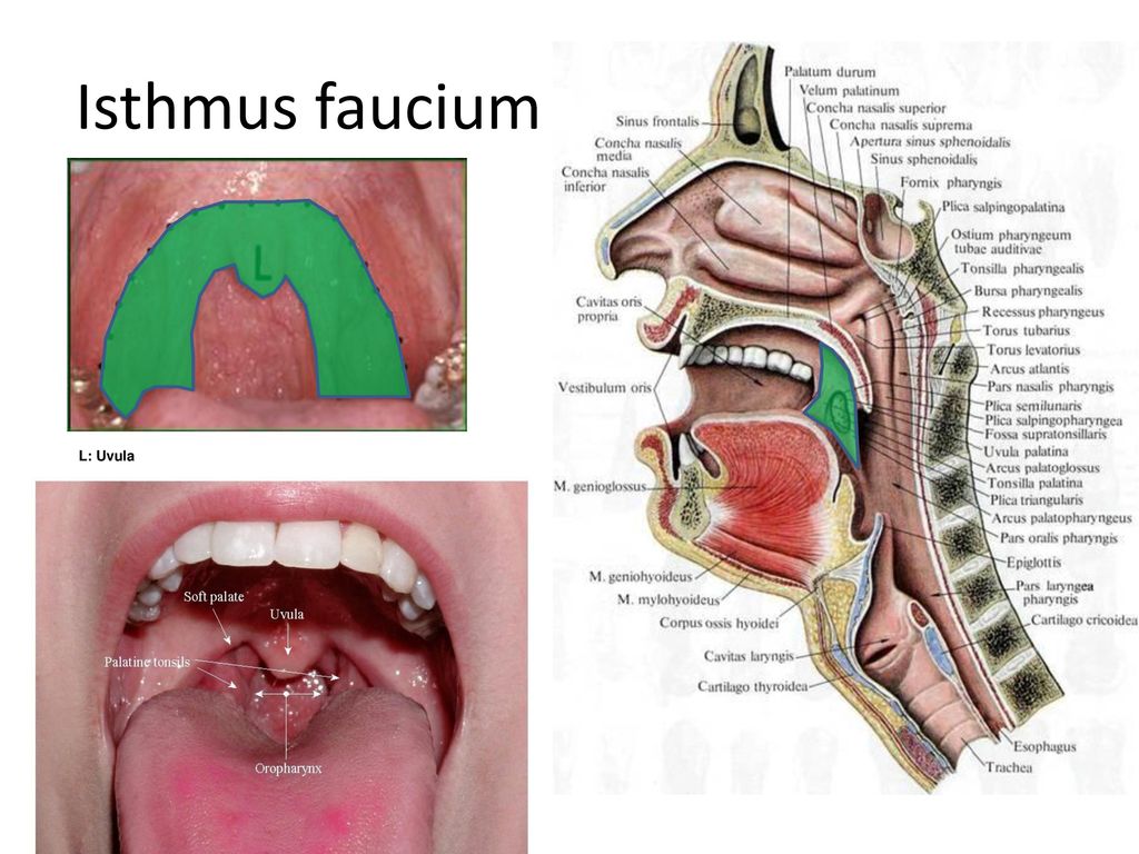 Isthmus faucium L: Uvula