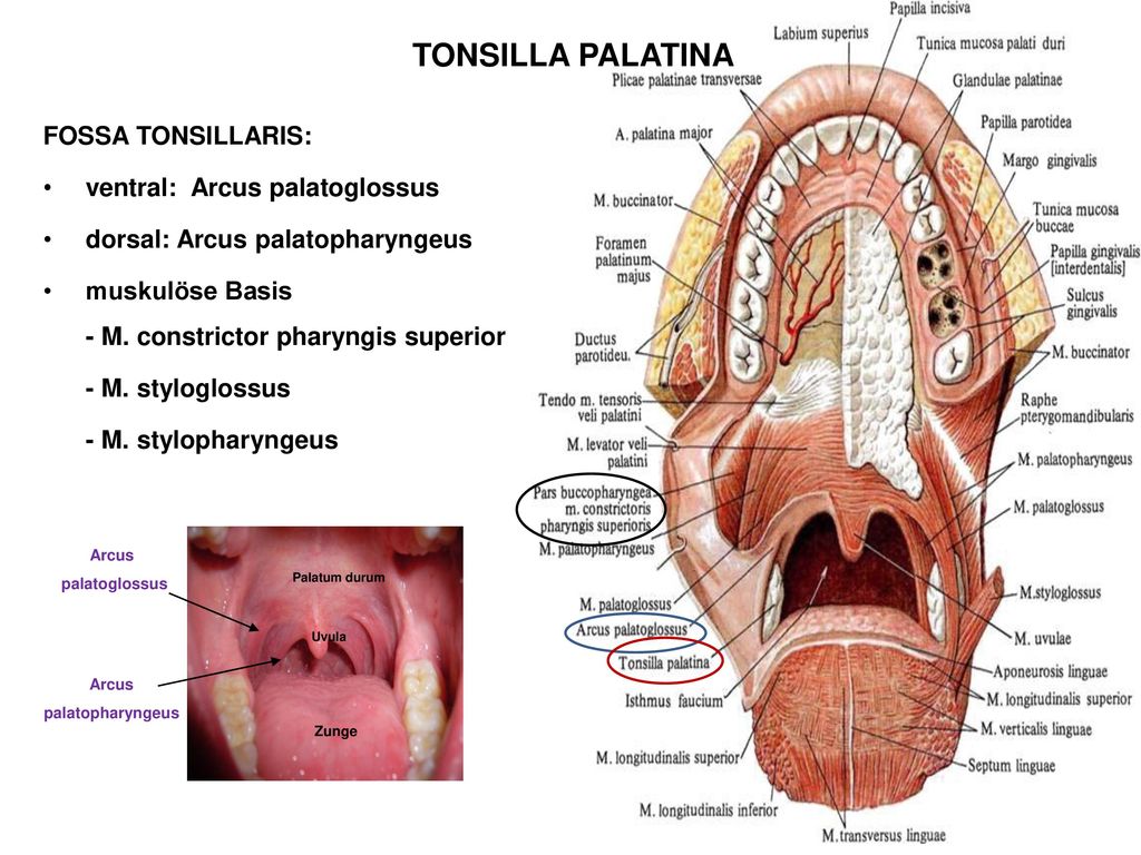 TONSILLA PALATINA FOSSA TONSILLARIS: ventral: Arcus palatoglossus