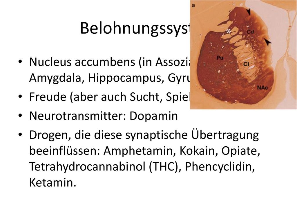 Belohnungssystem Nucleus accumbens (in Assoziation mit Amygdala, Hippocampus, Gyrus cinguli) Freude (aber auch Sucht, Spiel, Alkohol, usw.)
