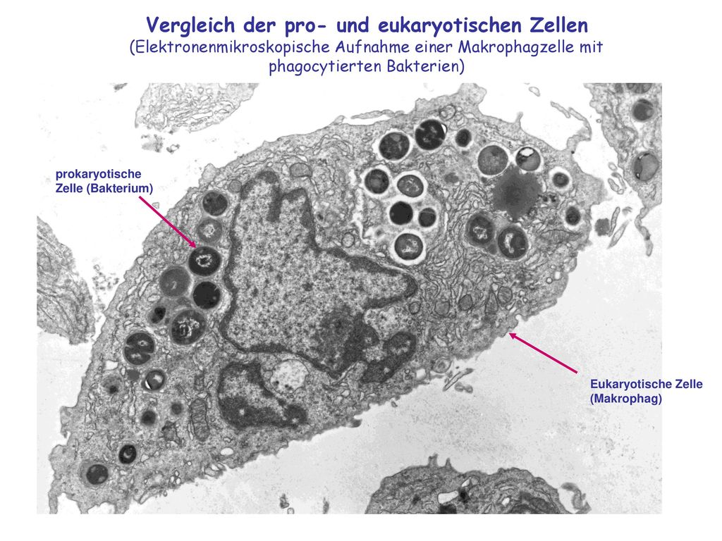 Vergleich der pro- und eukaryotischen Zellen (Elektronenmikroskopische Aufnahme einer Makrophagzelle mit phagocytierten Bakterien)