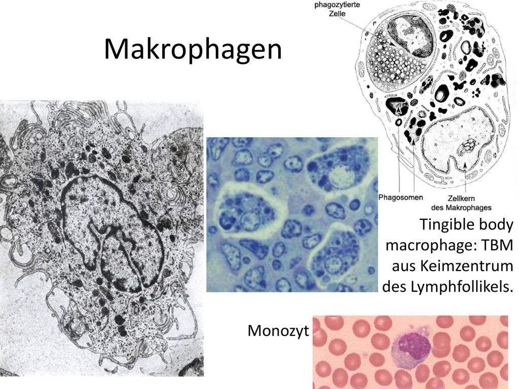 Makrophagen Tingible body macrophage: TBM aus Keimzentrum des Lymphfollikels. Monozyt