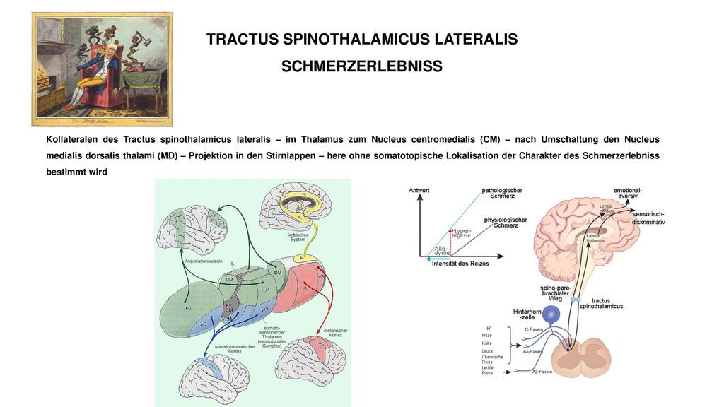 TRACTUS SPINOTHALAMICUS LATERALIS SCHMERZERLEBNISS