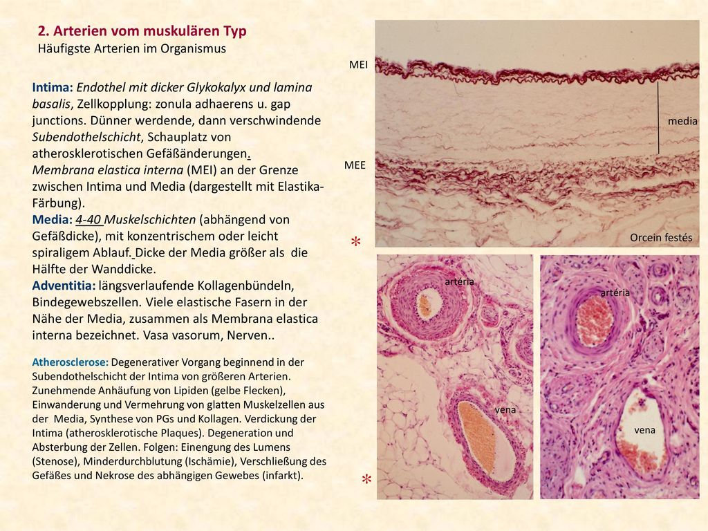 * * 2. Arterien vom muskulären Typ Häufigste Arterien im Organismus
