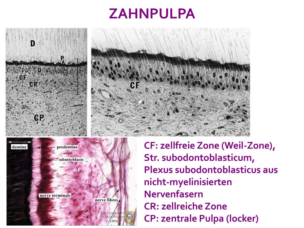ZAHNPULPA CF: zellfreie Zone (Weil-Zone), Str. subodontoblasticum, Plexus subodontoblasticus aus nicht-myelinisierten Nervenfasern.