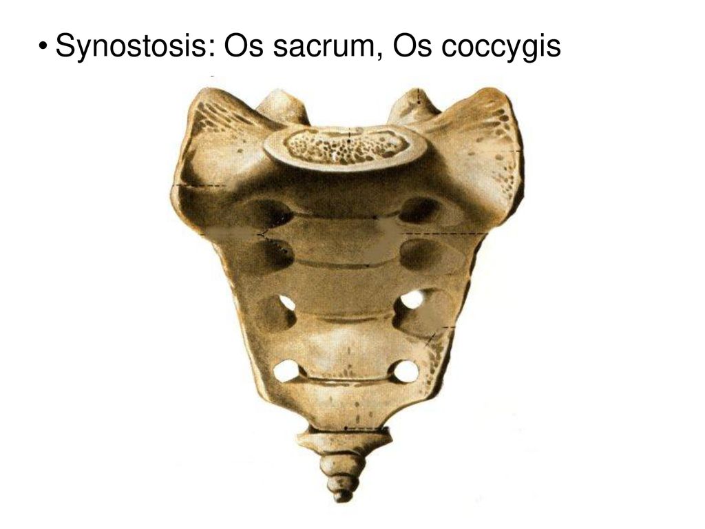 Synostosis: Os sacrum, Os coccygis