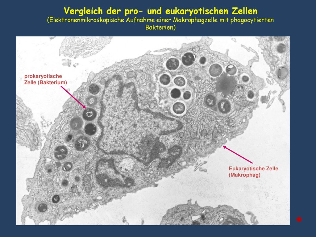 Vergleich der pro- und eukaryotischen Zellen (Elektronenmikroskopische Aufnahme einer Makrophagzelle mit phagocytierten Bakterien)
