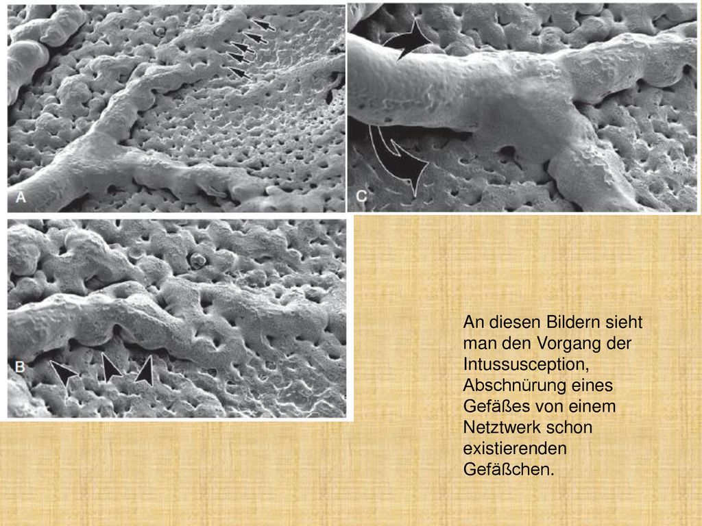 An diesen Bildern sieht man den Vorgang der Intussusception, Abschnürung eines Gefäßes von einem Netztwerk schon existierenden Gefäßchen.