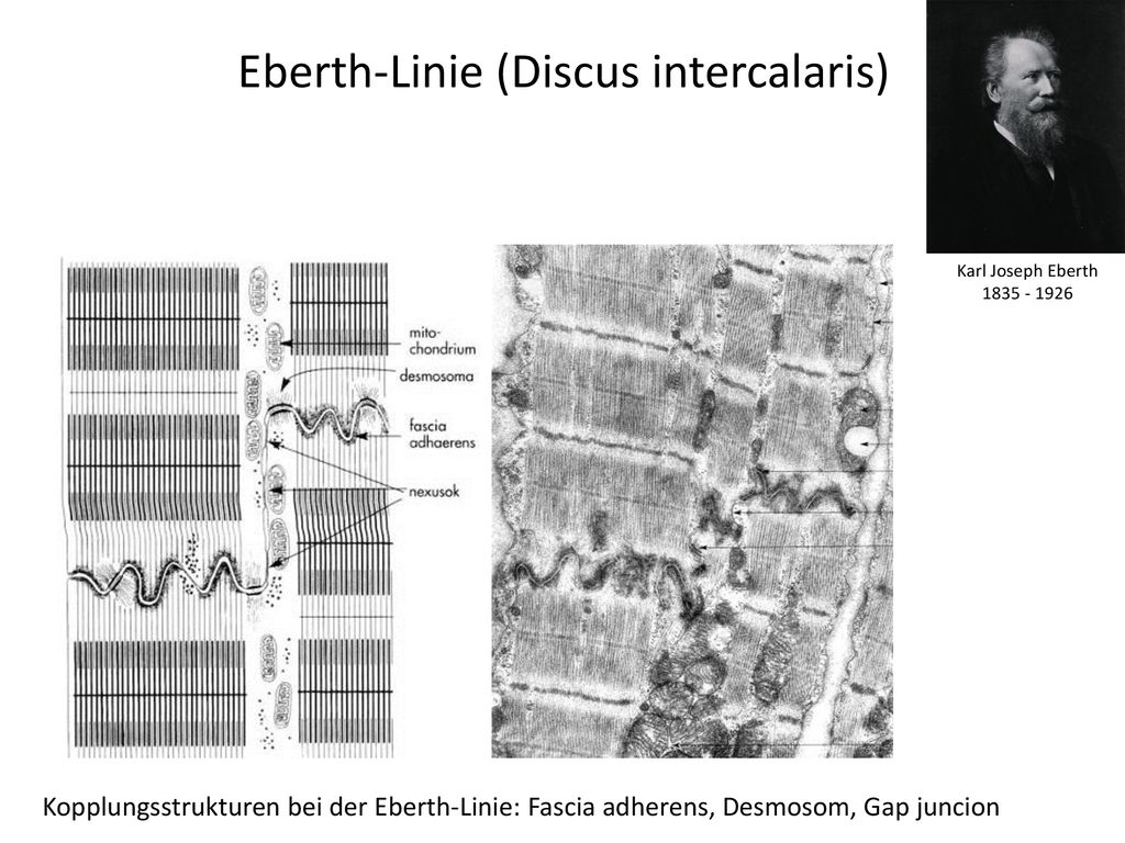 Eberth-Linie (Discus intercalaris)