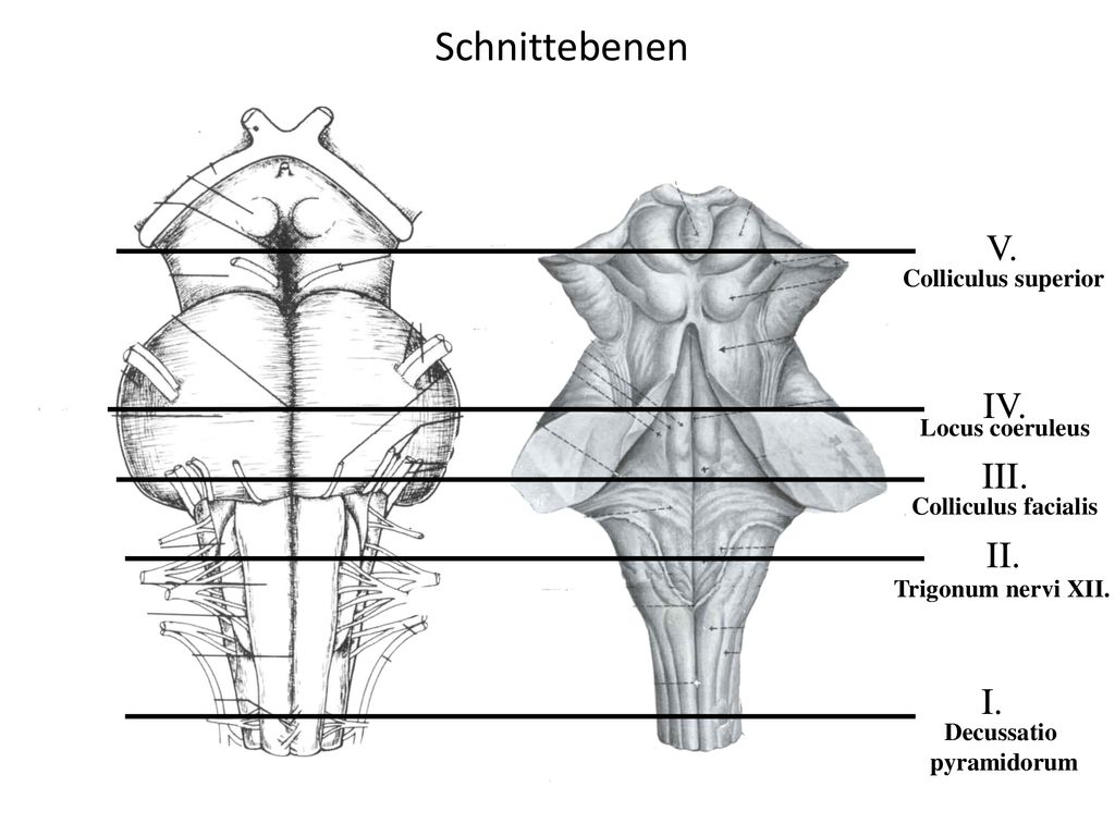 Schnittebenen V. IV. III. II. I. Colliculus superior Locus coeruleus