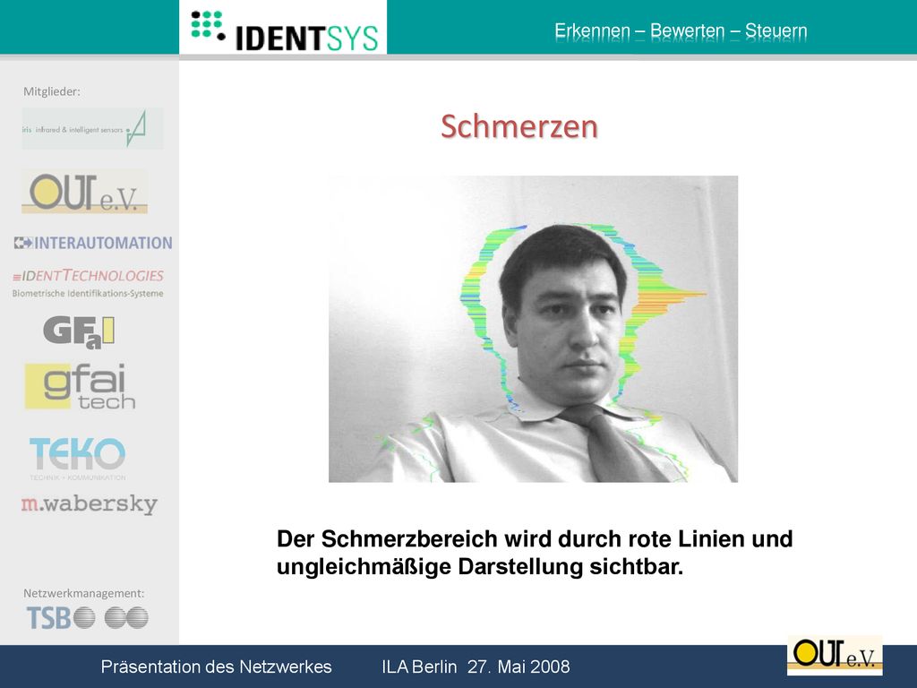 Schmerzen Der Schmerzbereich wird durch rote Linien und ungleichmäßige Darstellung sichtbar.