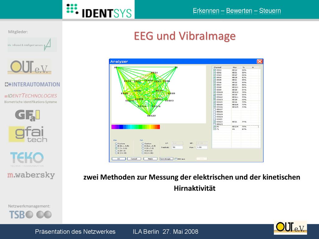 EEG und VibraImage zwei Methoden zur Messung der elektrischen und der kinetischen Hirnaktivität