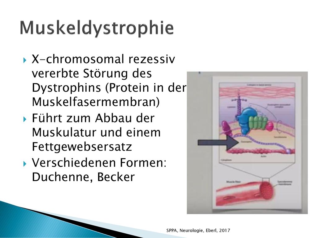 Muskeldystrophie X-chromosomal rezessiv vererbte Störung des Dystrophins (Protein in der Muskelfasermembran)