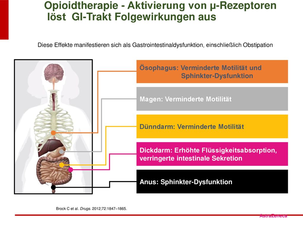 Opioidtherapie - Aktivierung von µ-Rezeptoren löst GI-Trakt Folgewirkungen aus