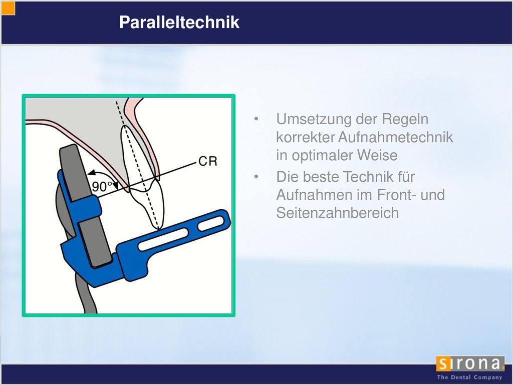 Paralleltechnik Umsetzung der Regeln korrekter Aufnahmetechnik in optimaler Weise.