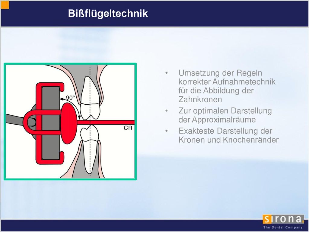 Bißflügeltechnik Umsetzung der Regeln korrekter Aufnahmetechnik für die Abbildung der Zahnkronen.