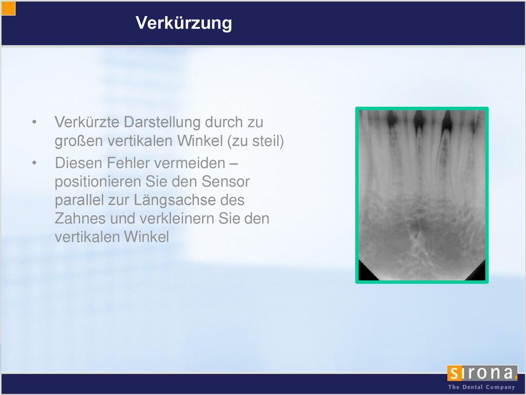 Verkürzung Verkürzte Darstellung durch zu großen vertikalen Winkel (zu steil)