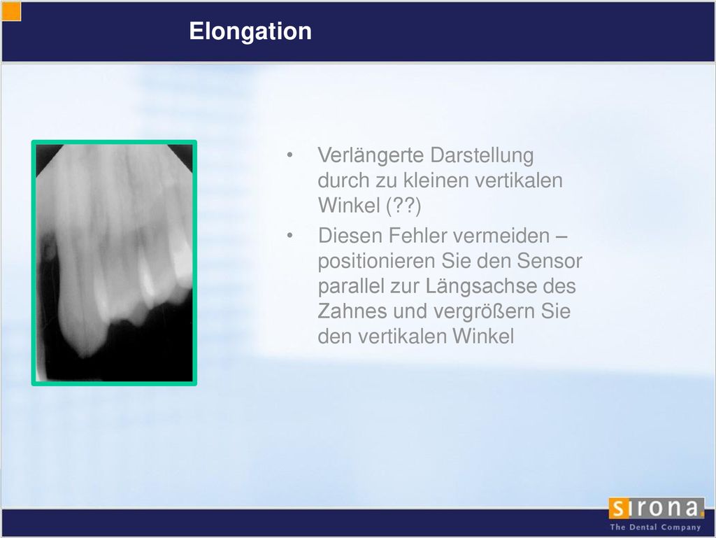 Elongation Verlängerte Darstellung durch zu kleinen vertikalen Winkel ( )