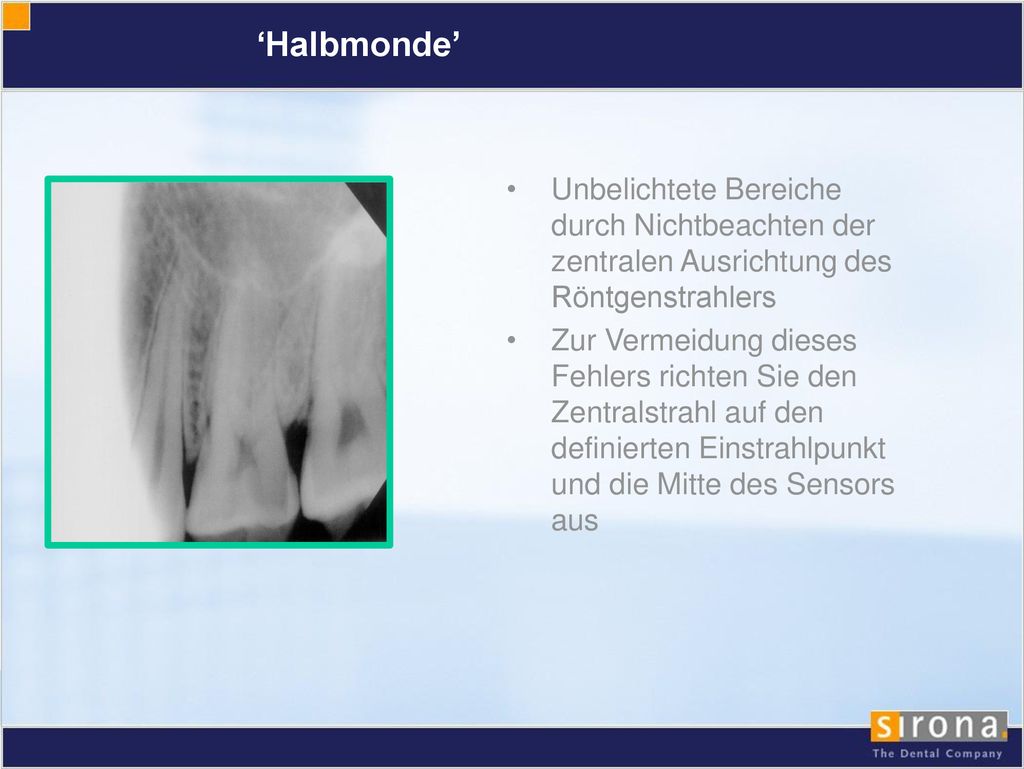 ‘Halbmonde’ Unbelichtete Bereiche durch Nichtbeachten der zentralen Ausrichtung des Röntgenstrahlers.
