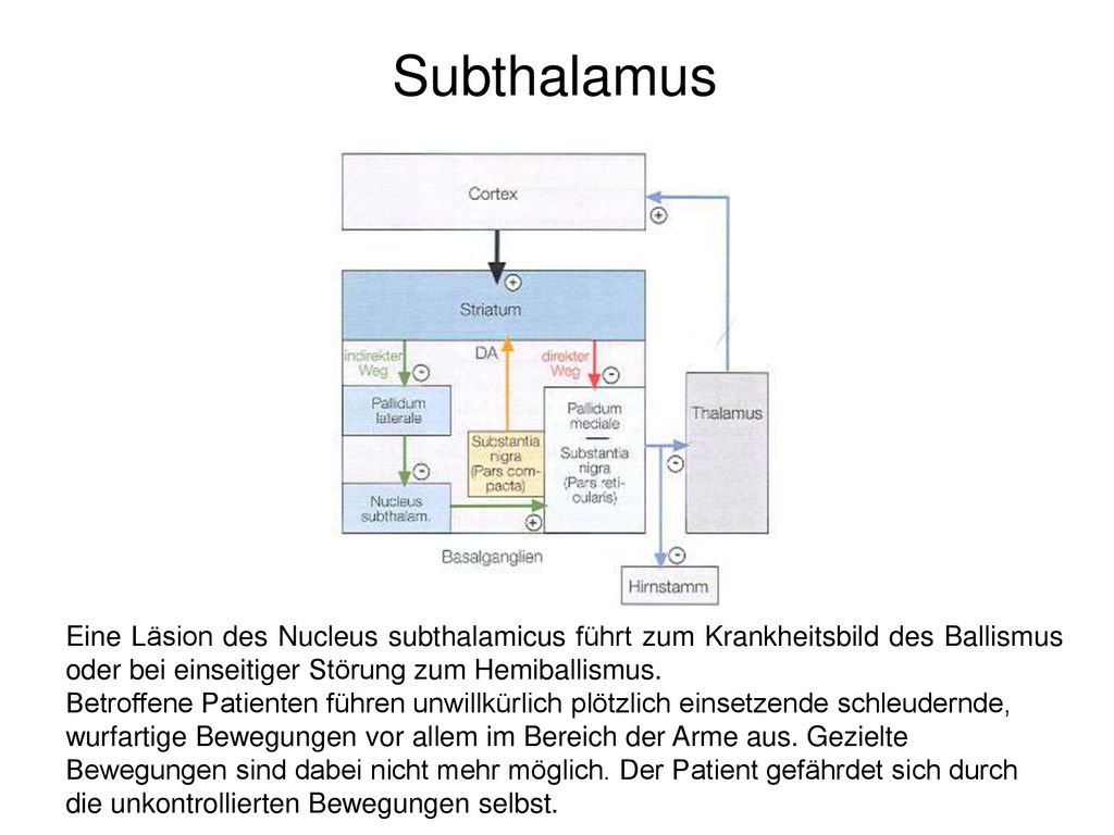 Subthalamus Eine Läsion des Nucleus subthalamicus führt zum Krankheitsbild des Ballismus oder bei einseitiger Störung zum Hemiballismus.