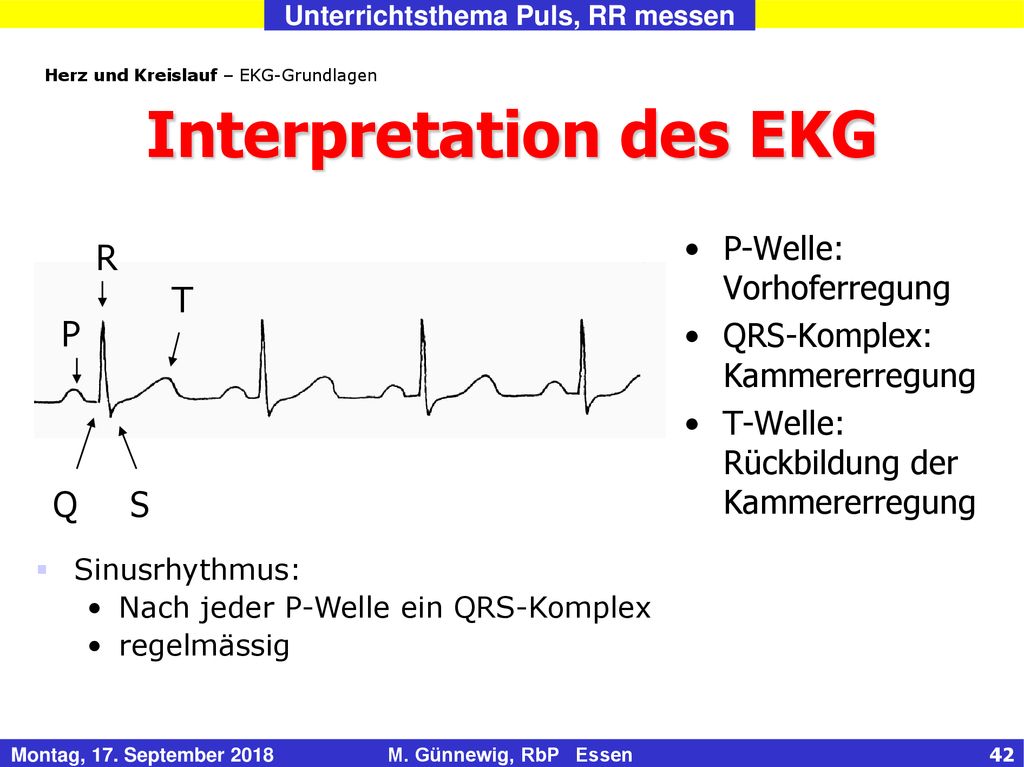 Interpretation des EKG