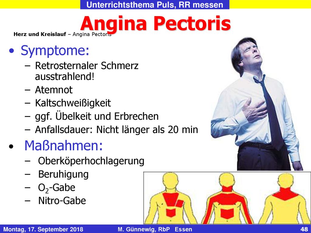 Angina Pectoris Symptome: Maßnahmen: