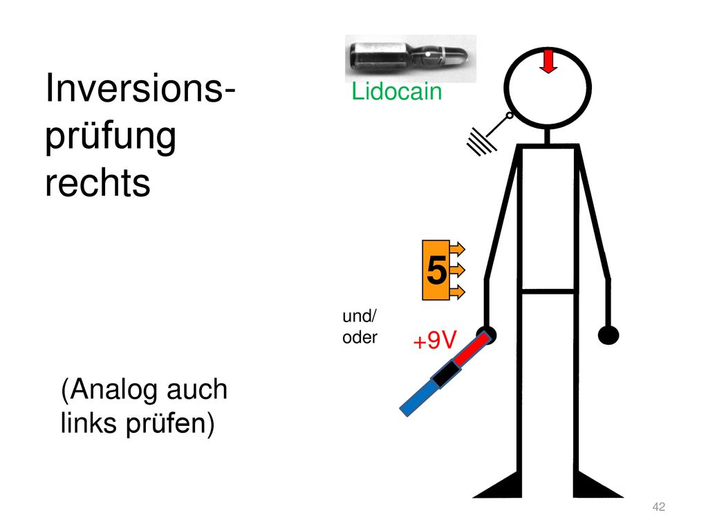 Inversions- prüfung rechts 5 (Analog auch links prüfen) Lidocain +9V