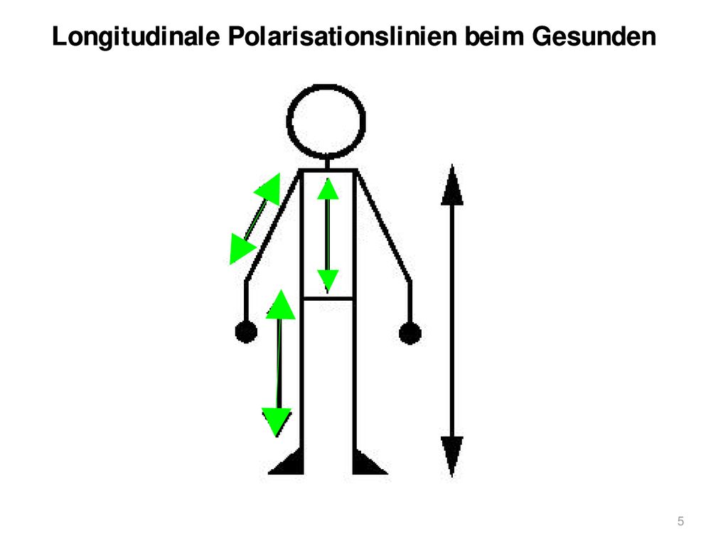 Am Körper gilt normalerweise ein longitudinaler Verlauf der Energielinien.