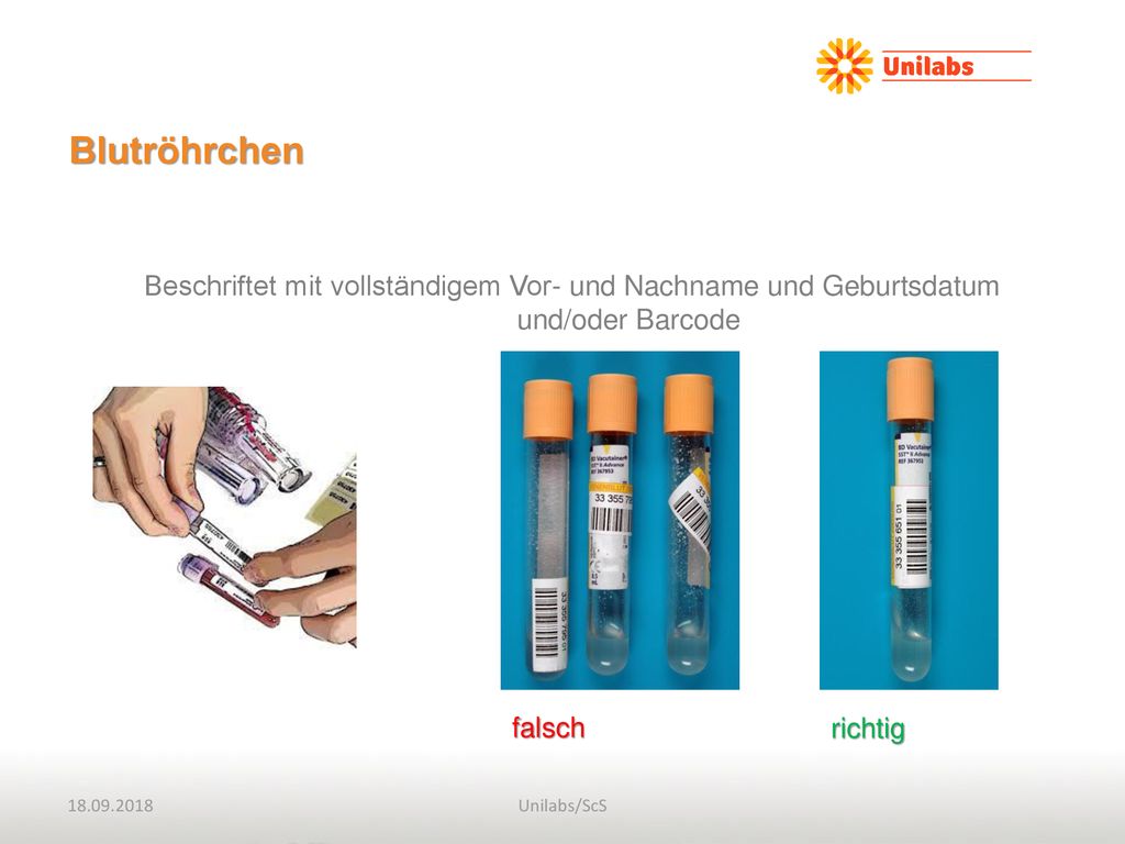 Blutröhrchen. Beschriftet mit vollständigem Vor- und Nachname und Geburtsdatum und/oder Barcode