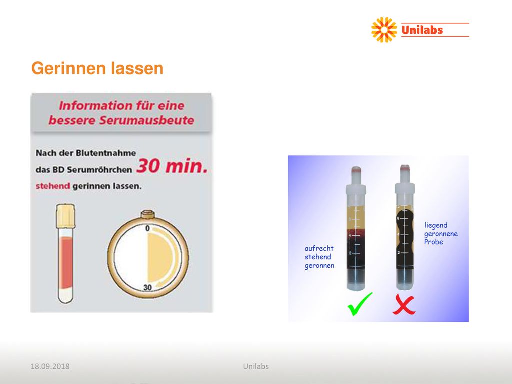 Gerinnen lassen. Gilt für Rö ohne Antikoagulanz (sprich Chemie Rö mit und ohne Gel). Ideal: Aufrecht stehend gerinnen lassen.