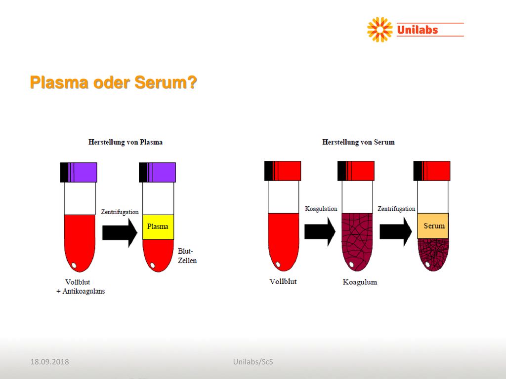 Plasma oder Serum Je nach Analyse wird vorzugsweise Serum oder Plasma verwendet, wobei zu beachten ist, dass Serum.