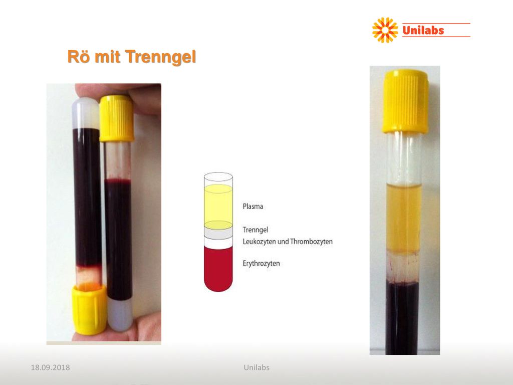 Rö mit Trenngel. Gerinnung muss vor Zentrifugation vollständig abgelaufen sein!