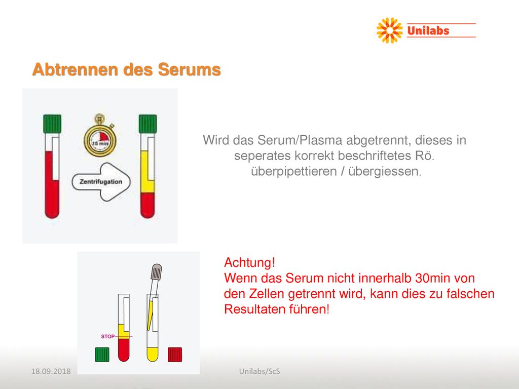 Abtrennen des Serums. Wird das Serum/Plasma abgetrennt, dieses in seperates korrekt beschriftetes Rö. überpipettieren / übergiessen.