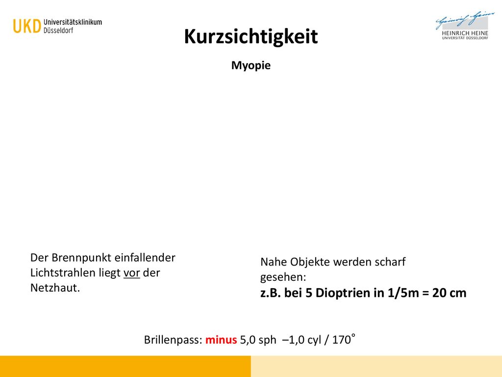 Kurzsichtigkeit z.B. bei 5 Dioptrien in 1/5m = 20 cm Myopie