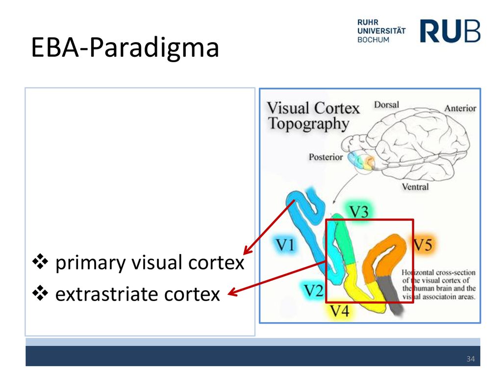 EBA-Paradigma primary visual cortex extrastriate cortex