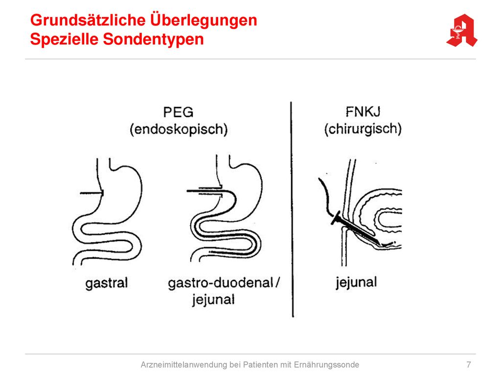 Grundsätzliche Überlegungen Spezielle Sondentypen