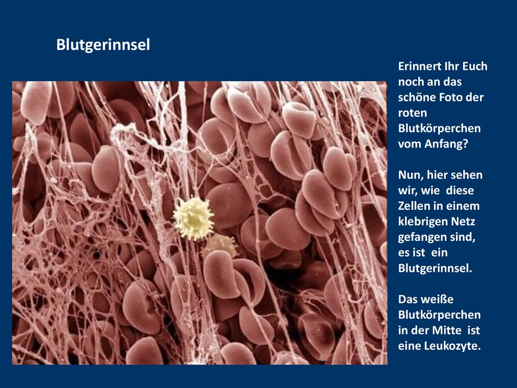 Blutgerinnsel Erinnert Ihr Euch noch an das schöne Foto der roten Blutkörperchen vom Anfang