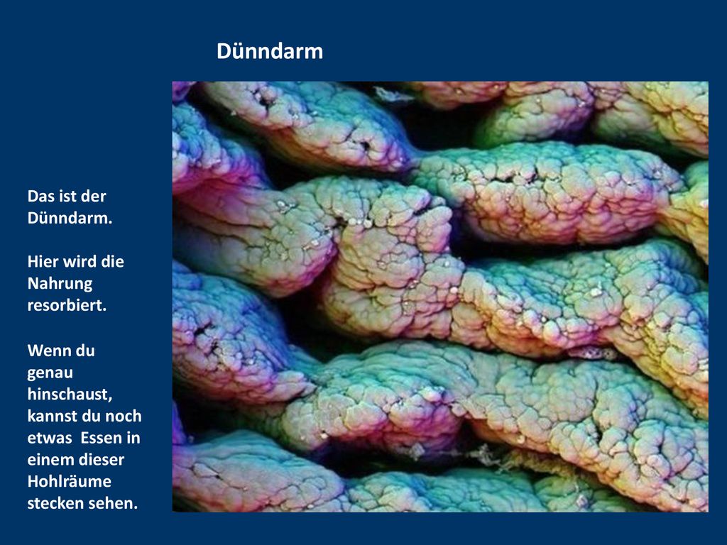 Dünndarm Das ist der Dünndarm. Hier wird die Nahrung resorbiert.