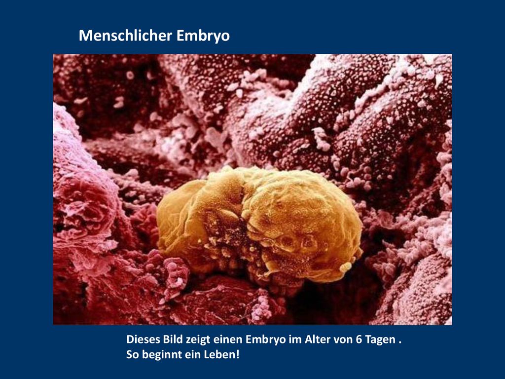 Menschlicher Embryo Dieses Bild zeigt einen Embryo im Alter von 6 Tagen . So beginnt ein Leben!