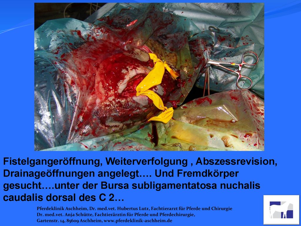 Fistelgangeröffnung, Weiterverfolgung , Abszessrevision, Drainageöffnungen angelegt…. Und Fremdkörper gesucht….unter der Bursa subligamentatosa nuchalis caudalis dorsal des C 2…
